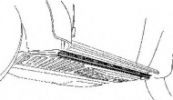 Днище SCHLIECKMANN 401221