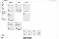 Глушитель DINEX 128100122